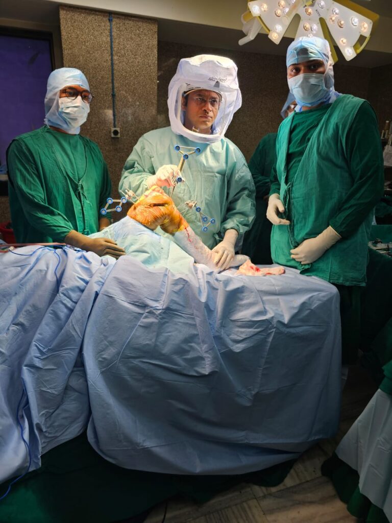 Dr. Varun Chouhan performing robotic-assisted knee replacement at Bombay Hospital Indore